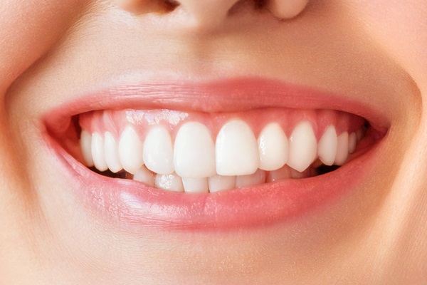 What Is Full Mouth Reconstruction?